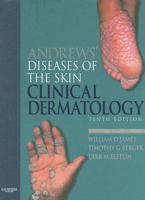 Andrews Diseases of the Skin: Clinical Dermatology